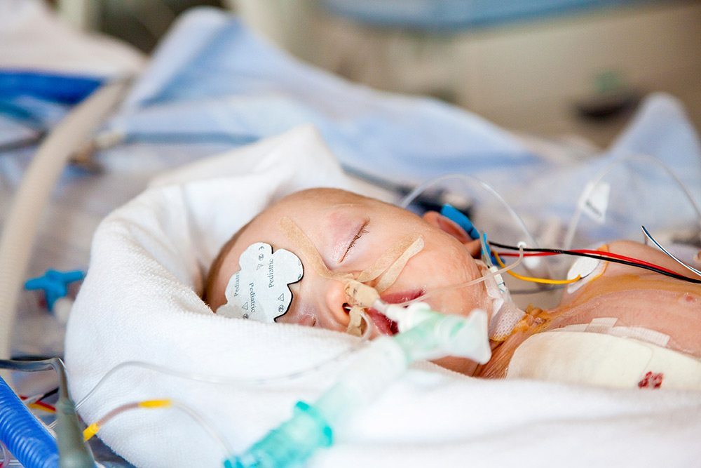 Hypoxic-Ischemic Encephalopathy (HIE): Signs and Symptoms