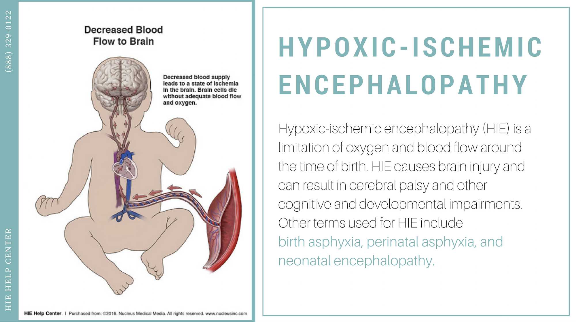 Hypoxic-Ischemic Encephalopathy - Infographics and Images