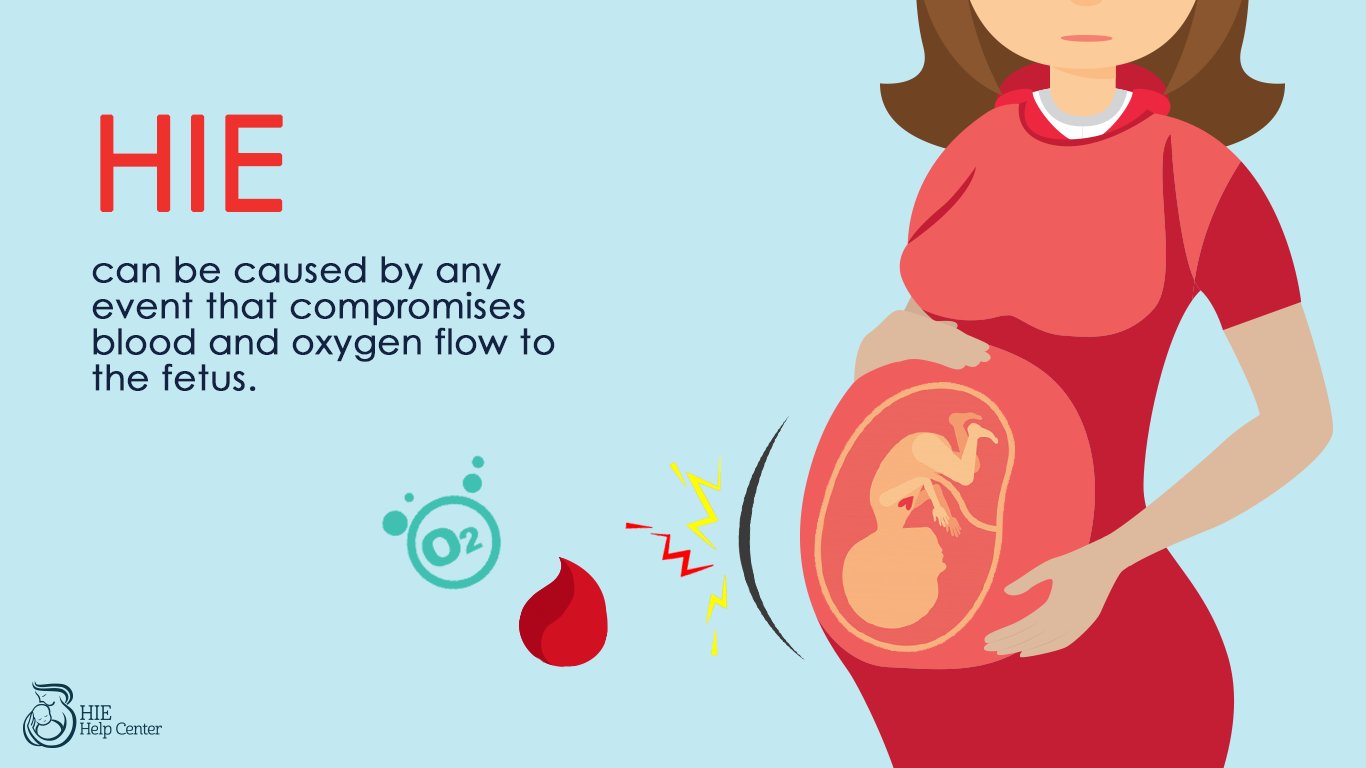 HIE can be caused by any event that compromises blood and oxygen flow to the fetus