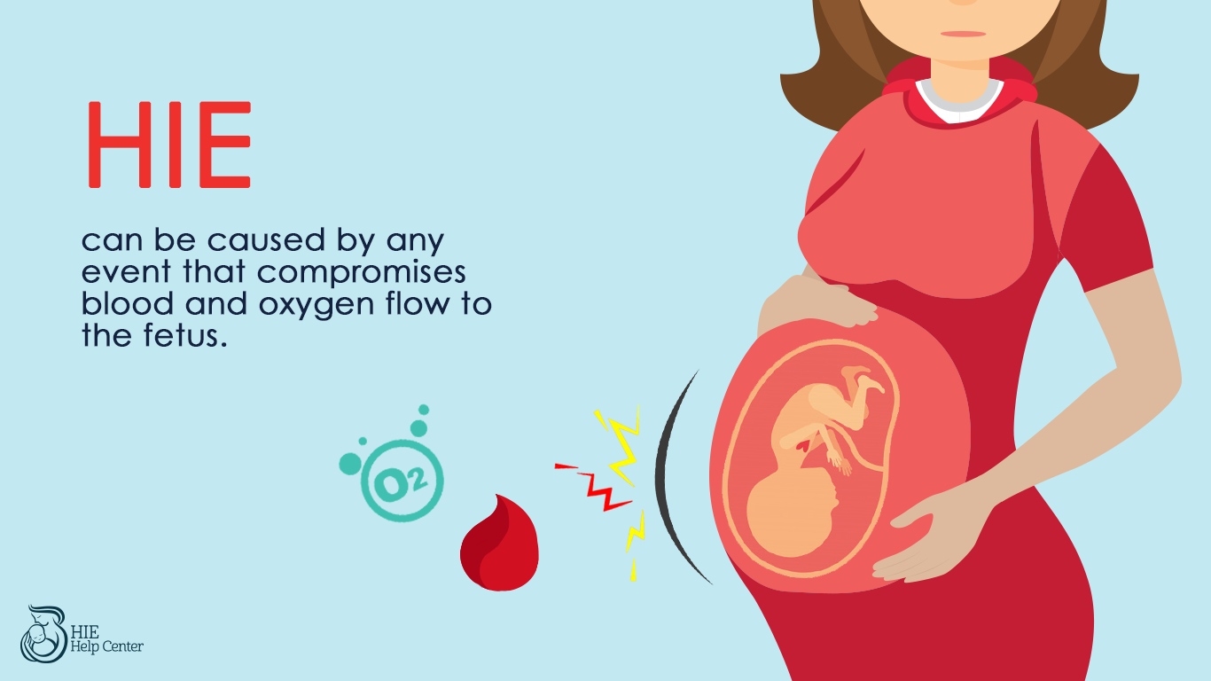 Specific Brain Cells Affected by Low Oxygen Levels at Birth | HIE Help ...