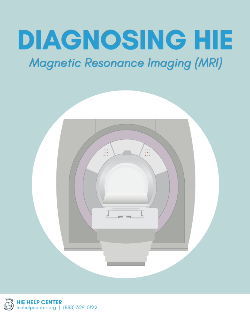 Diagnosing HIE Through MRI