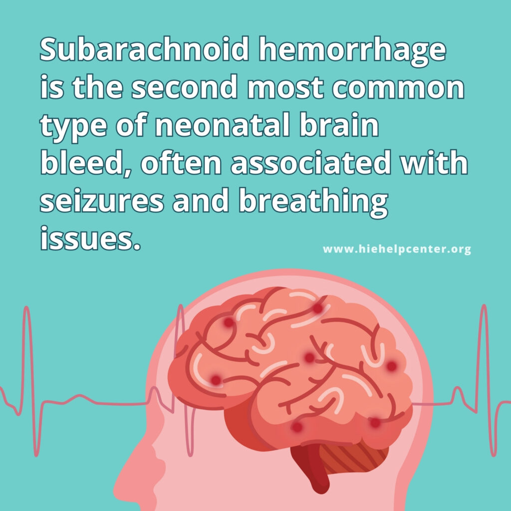 Intracranial Hemorrhages (brain Bleeds) And Birth Injuries