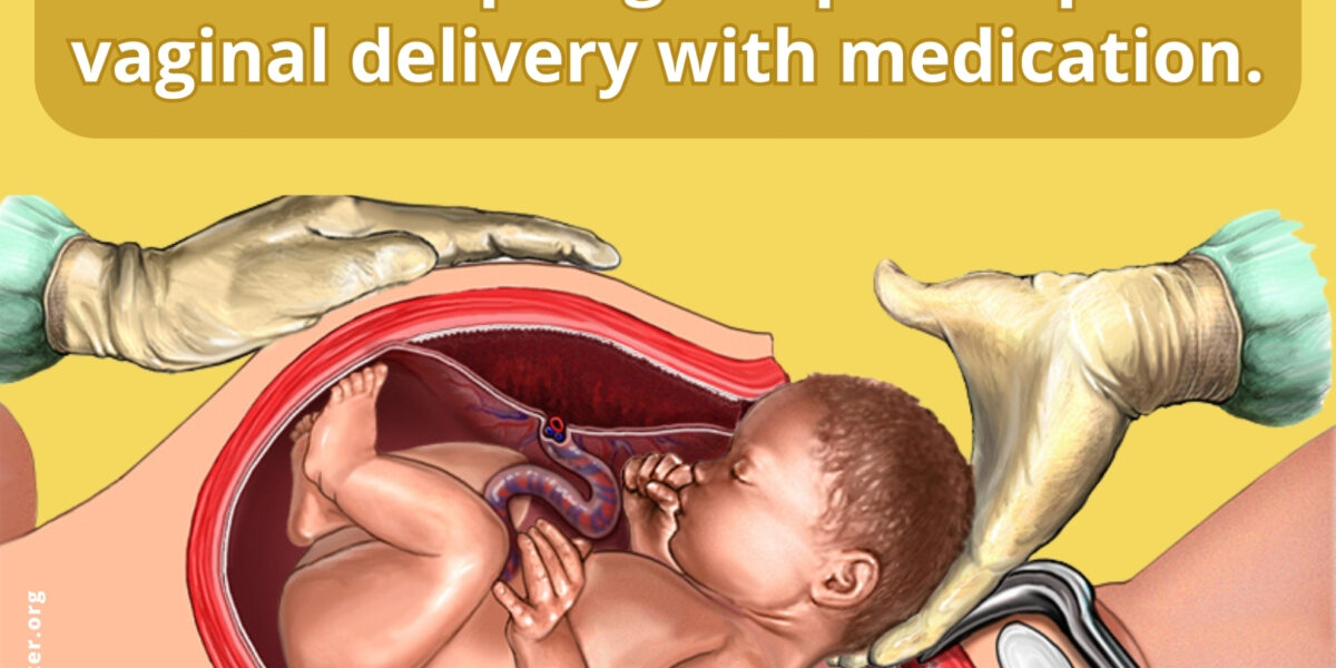 Delivery Methods: C-Section Delivery