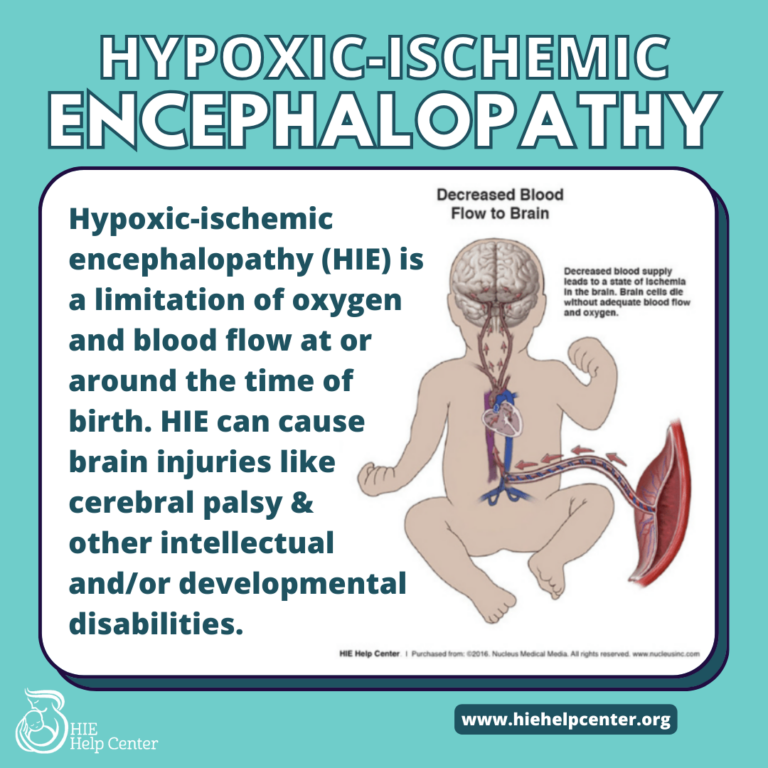 Causes and Risk Factors for Hypoxic-Ischemic Encephalopathy