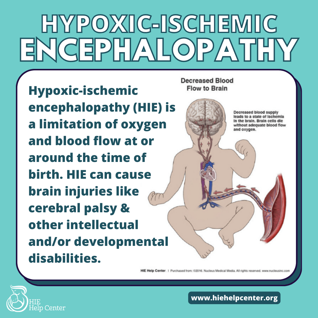 Hypoxic-ischemic encephalopathy (HIE) is a limitation of oxygen and blood flow at or around the time of birth. HIE can cause brain injuries like cerebral palsy & other intellectual and/or developmental disabilities.